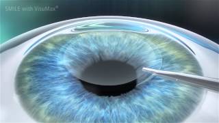 Уважаемые клиенты,   Мы являемся специализированной офтальмологической лазерной клиникой, которая занимается проблемами коррекции зрения, позволяя жить без очков и контактных линз